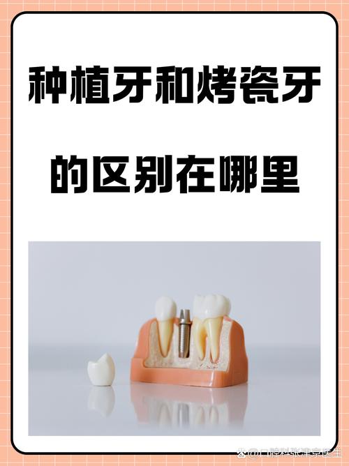 植骨和种牙是一起的吗-图2
