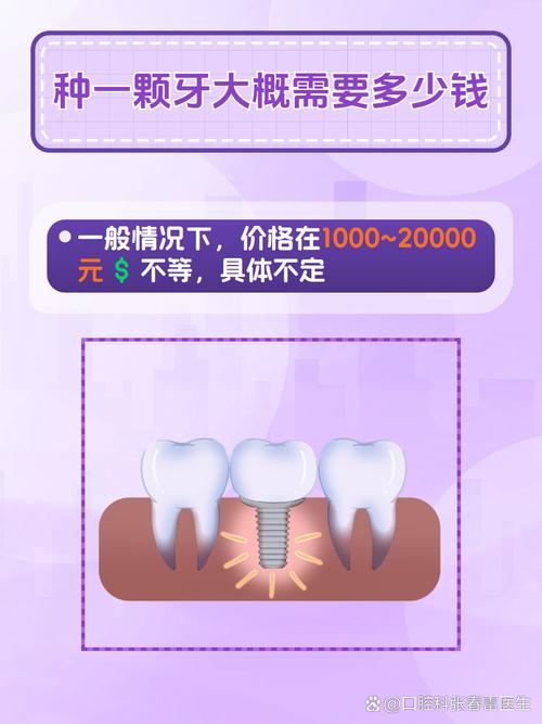 种植一颗牙大概需要多少钱?材料和医院选择会影响价格吗?-图3 种植一颗牙大概需要多少钱?材料和医院选择会影响价格吗?-图3