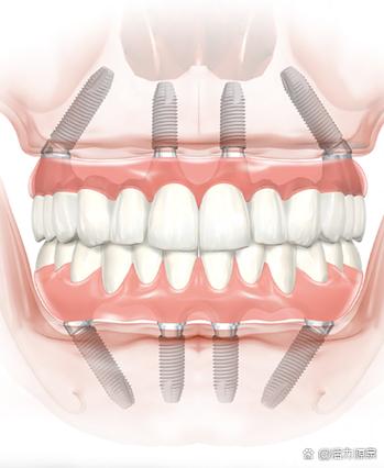 内蒙古3D种牙机构数量有多少?-图2 内蒙古3D种牙机构数量有多少?-图2
