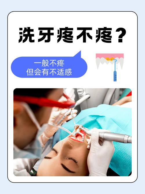 去医院洗牙都有哪些方法？各自适合什么情况？-图2