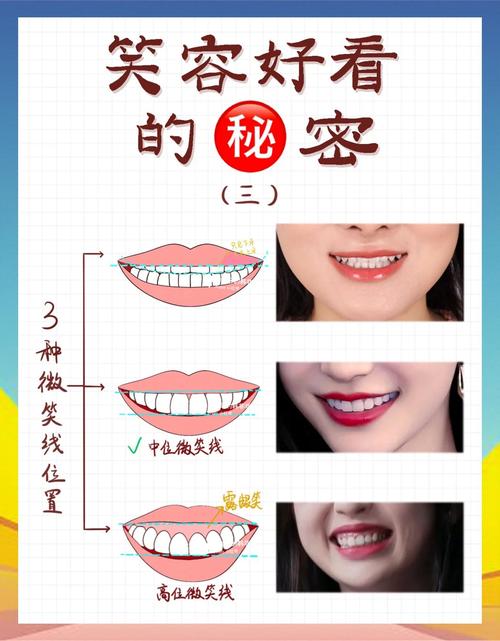 正畸笑线调整，真的要等到最后吗？-图1