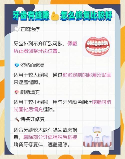 门牙有缝的最好修补方法-图1