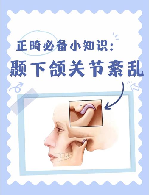 正畸为何引发颞颌关节紊乱和颈椎病?-图2 正畸为何引发颞颌关节紊乱和颈椎病?-图2