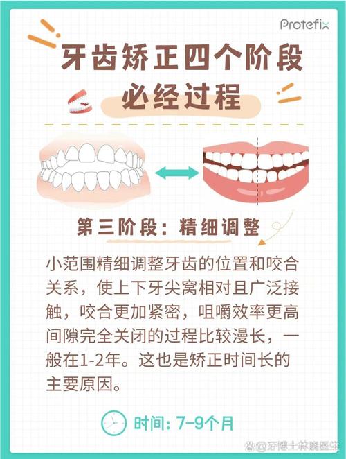 正畸中2火4技术具体指什么?-图1 正畸中2火4技术具体指什么?-图1