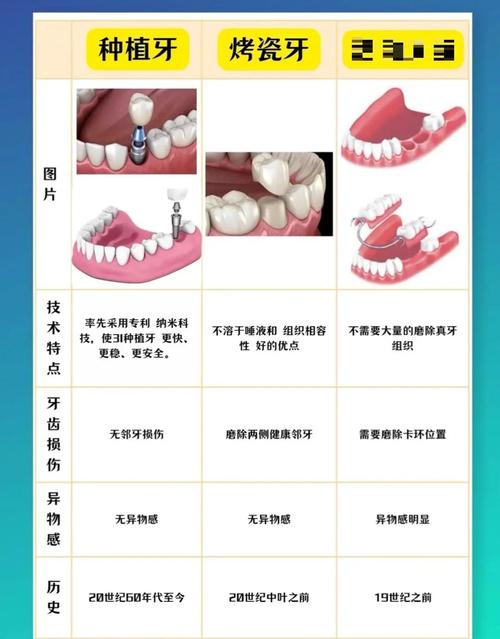 全口牙半种半襄多少钱-图3 全口牙半种半襄多少钱-图3