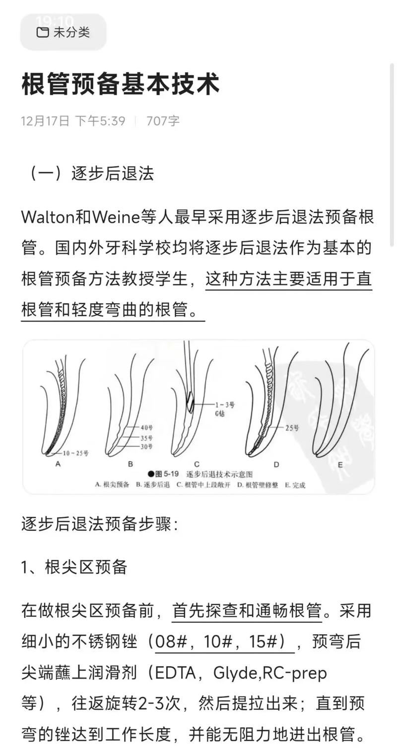 大锥度根管治疗预备方法-图1