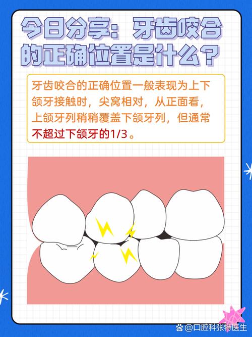 确定咬合关系有几种方法-图1