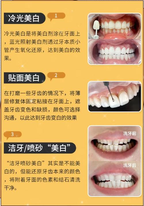 史上最好牙齿美白法真有效?安全适用性如何?-图2 史上最好牙齿美白法真有效?安全适用性如何?-图2