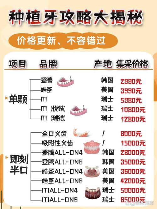医院种牙一颗多少钱?-图3 医院种牙一颗多少钱?-图3