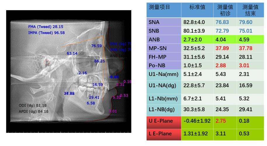 北医正畸头颅测量分析法有何独特优势与应用价值？-图2