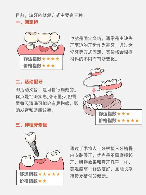 磨牙空缺最好的修复方法-图1