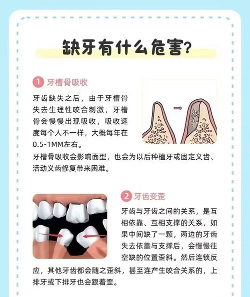 两边都缺牙能同时种吗-图3