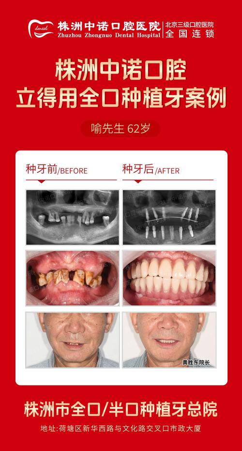 一般口腔医院能种牙吗-图1 一般口腔医院能种牙吗-图1