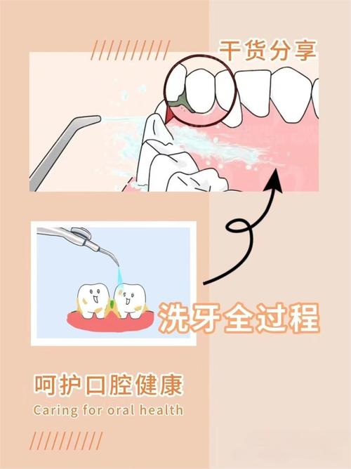 杭州西湖正确的洗牙方法-图1 杭州西湖正确的洗牙方法-图1