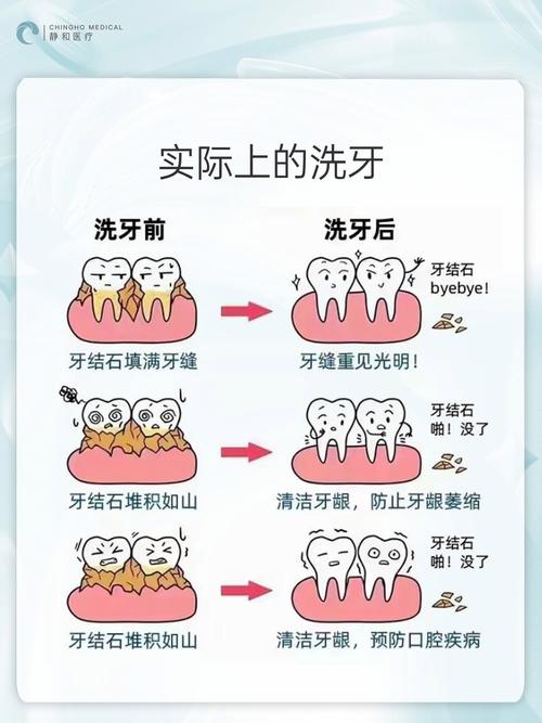 杭州西湖正确的洗牙方法-图3