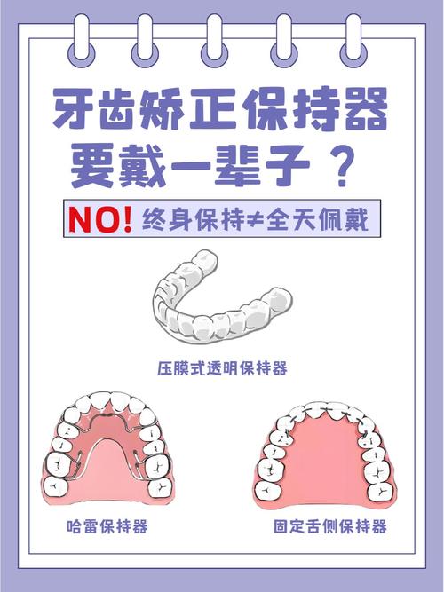正畸前为什么要戴保持器-图1