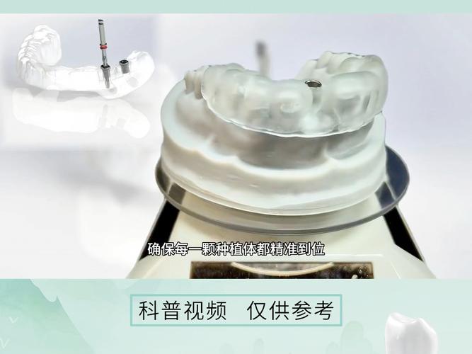 数字化导板种牙精准度如何？临床效果与优势几何？-图1