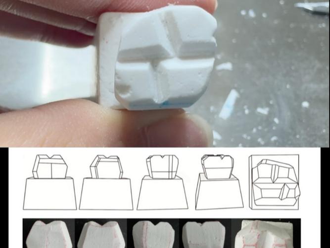 下颌6牙蜡雕刻步骤方法有哪些?详细步骤如何操作?-图1 下颌6牙蜡雕刻步骤方法有哪些?详细步骤如何操作?-图1