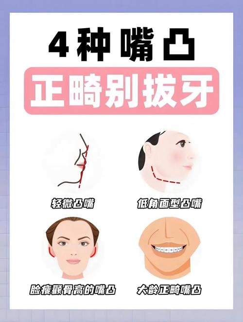 正畸不拔牙vs拔牙，到底该怎么选？效果差异大吗？-图1