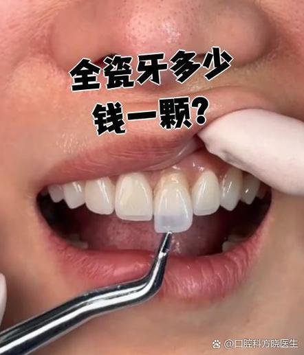 种一牙六千韩国烤瓷牙,价格合理质量有保障吗?-图1 种一牙六千韩国烤瓷牙,价格合理质量有保障吗?-图1