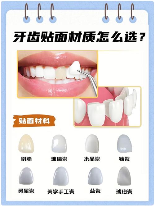 树脂牙齿抛光最简单方法-图2 树脂牙齿抛光最简单方法-图2