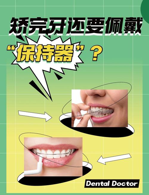 正畸保持器如何调整形状-图3 正畸保持器如何调整形状-图3