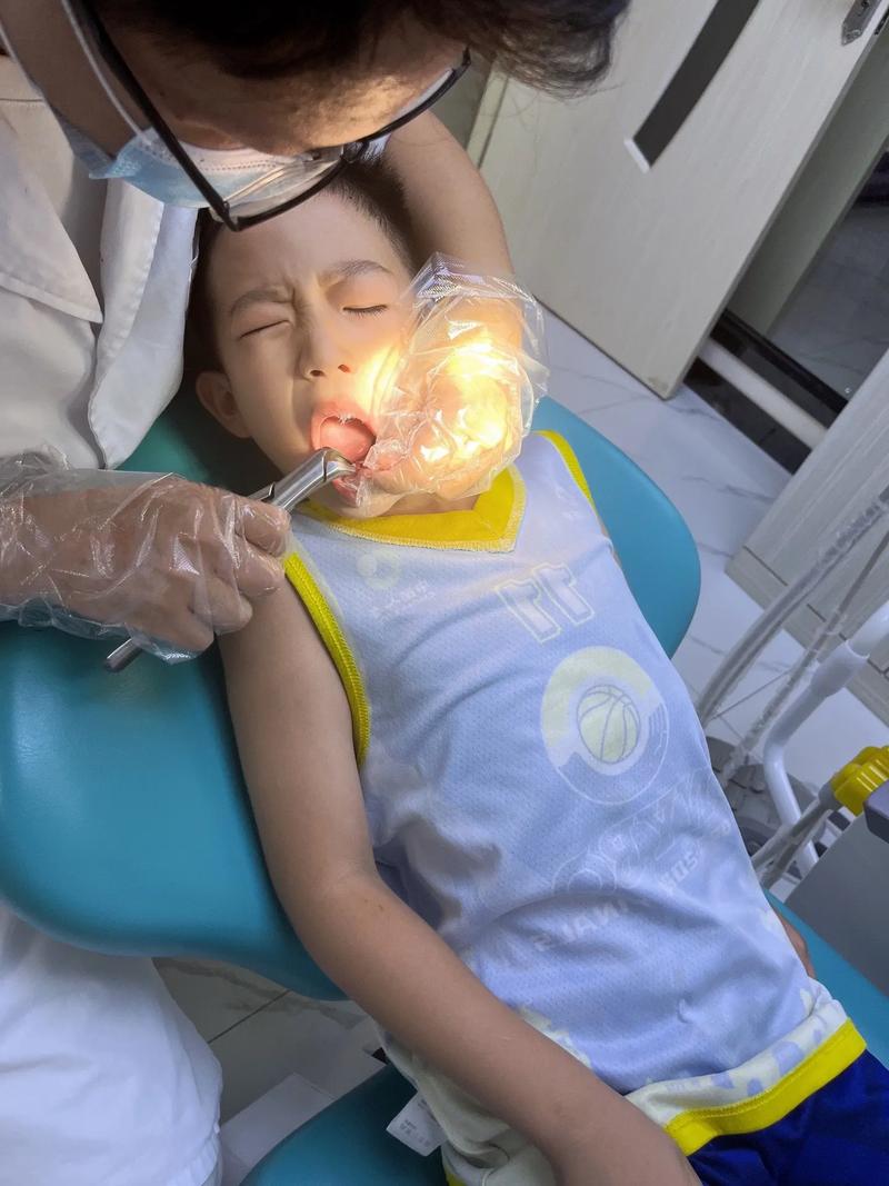 宜春拜博口腔医院拔牙-图3