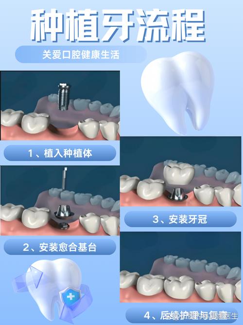 人工种植牙种植体种入的详细操作步骤和注意事项是什么？-图2