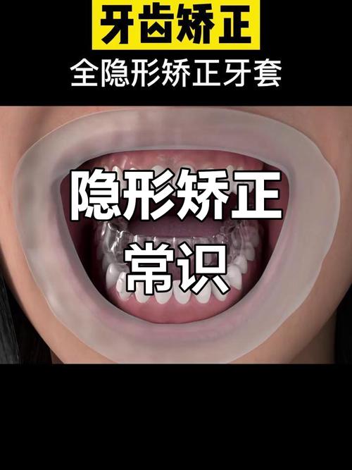 隐形牙套正畸效果怎么样？效果真的靠谱吗？-图3