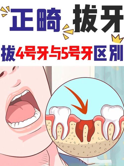 正畸时，横向阻生齿是否必须拔除？不拔会影响矫正效果吗？-图3