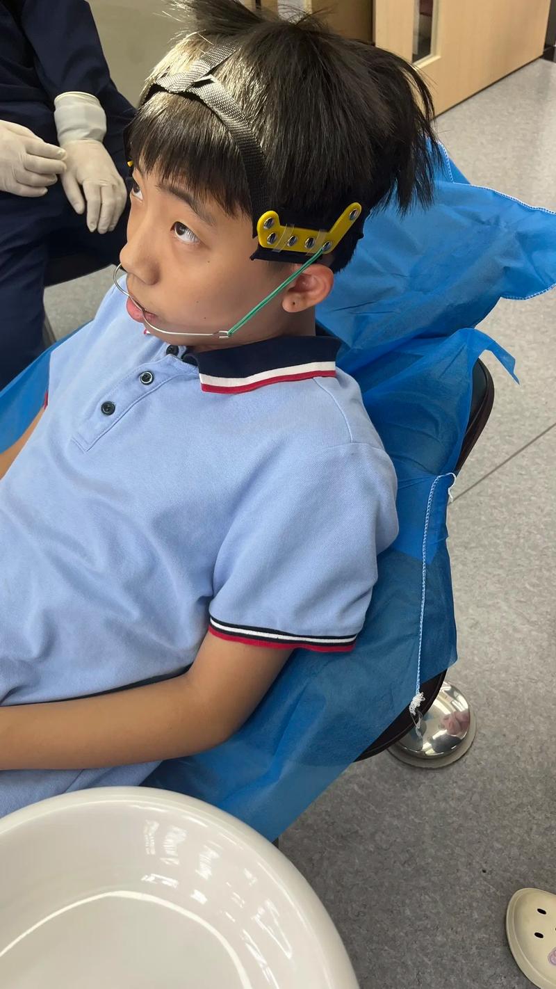 戴正畸头帽期间，还能正常吃东西吗？-图1