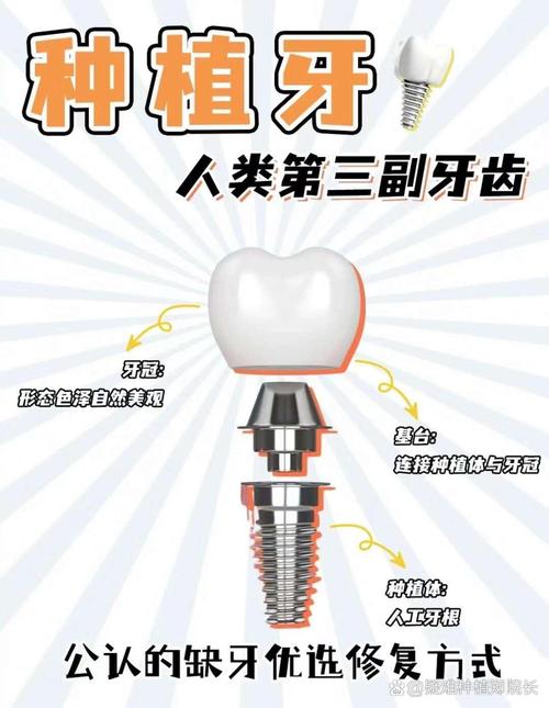 种牙的材料究竟是什么?都有哪些种类和材质?-图1 种牙的材料究竟是什么?都有哪些种类和材质?-图1