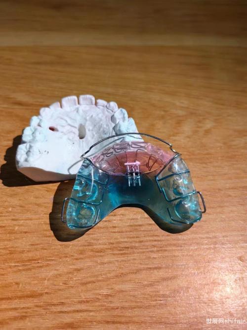 唇弓错位修复用什么方法？不同错位情况如何选择修复方案？-图1