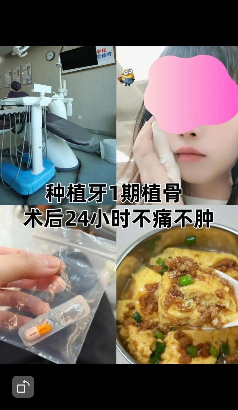 无锡中医院种牙效果如何？技术靠谱吗？价格贵不贵？值得选吗？-图3