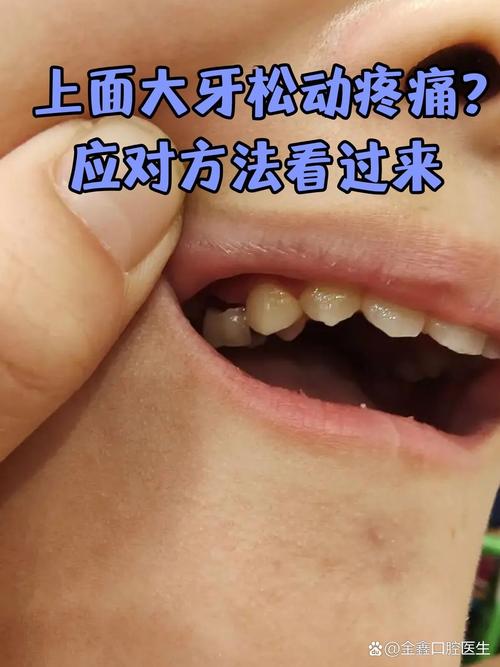 种牙碰到上颌窦说话疼是什么原因？该如何处理？-图3