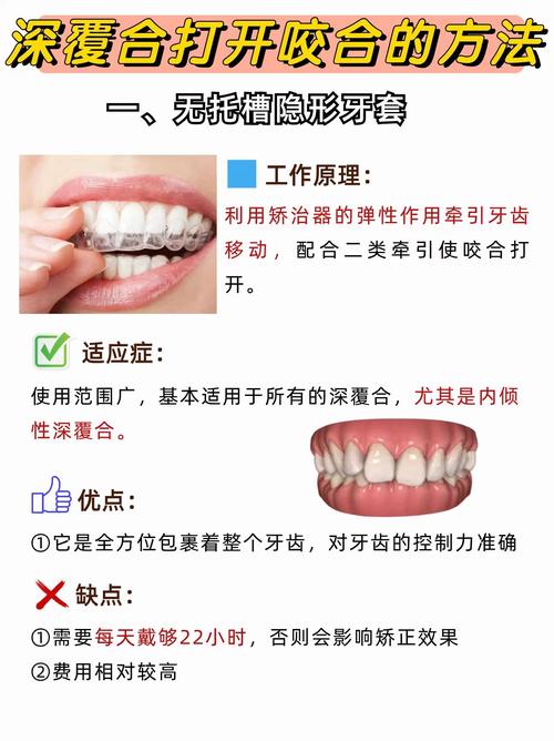 口腔正畸矫正治疗时,牙齿中线在矫正阶段什么时候定最佳时间?-图2 口腔正畸矫正治疗时,牙齿中线在矫正阶段什么时候定最佳时间?-图2