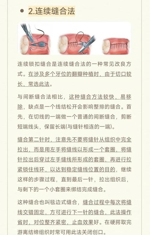 二类错合畸形手术方法-图1 二类错合畸形手术方法-图1