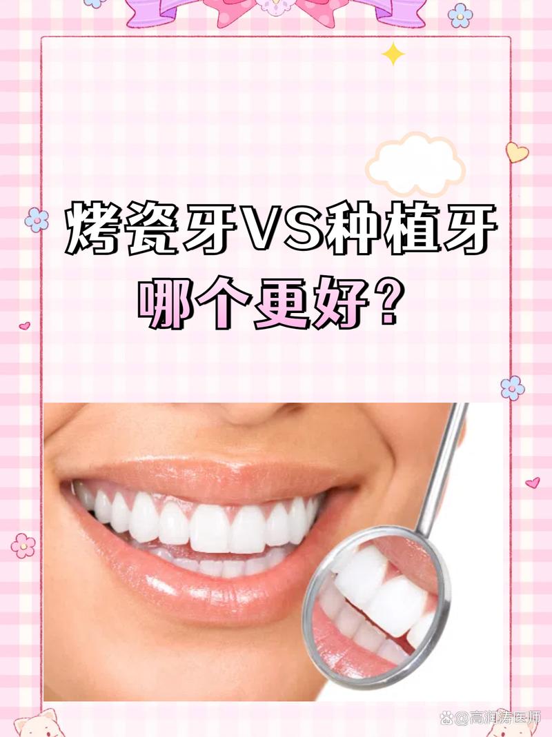 烤瓷牙和种牙，哪种牙齿修复方式更适合你？-图2
