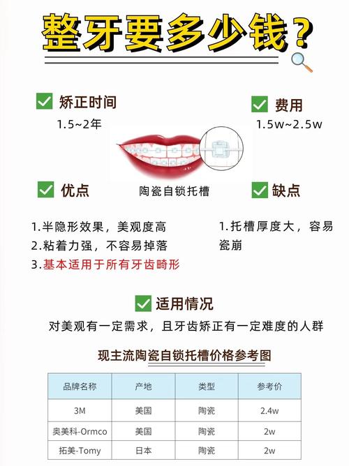 拜博口腔箍牙多少钱?价格范围是多少?-图2 拜博口腔箍牙多少钱?价格范围是多少?-图2