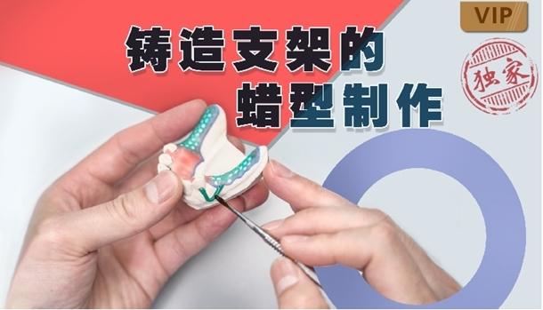 支架蜡型腊堤的正确制作方法中,详细步骤和操作要点有哪些?-图1 支架蜡型腊堤的正确制作方法中,详细步骤和操作要点有哪些?-图1