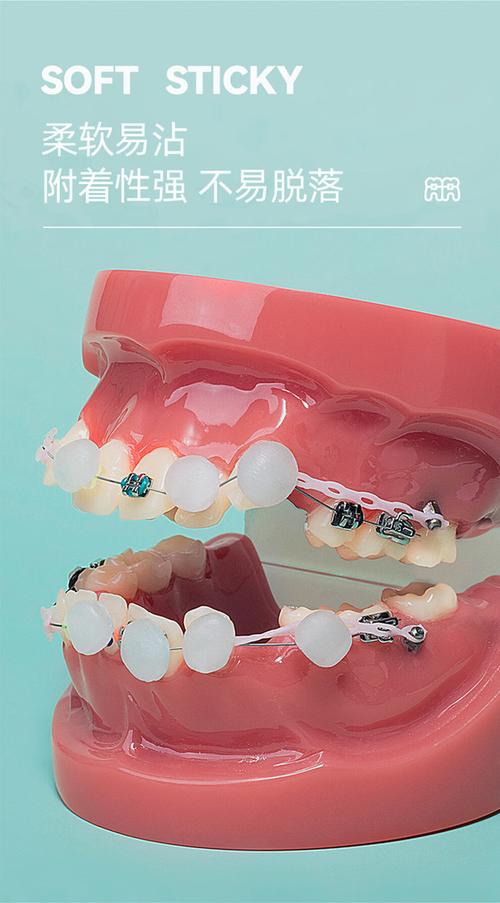 正畸保护蜡适合多大使用-图2