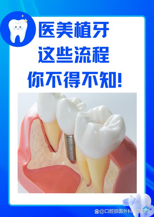 种牙去私人医院可以吗？安全性和费用如何保障？-图3