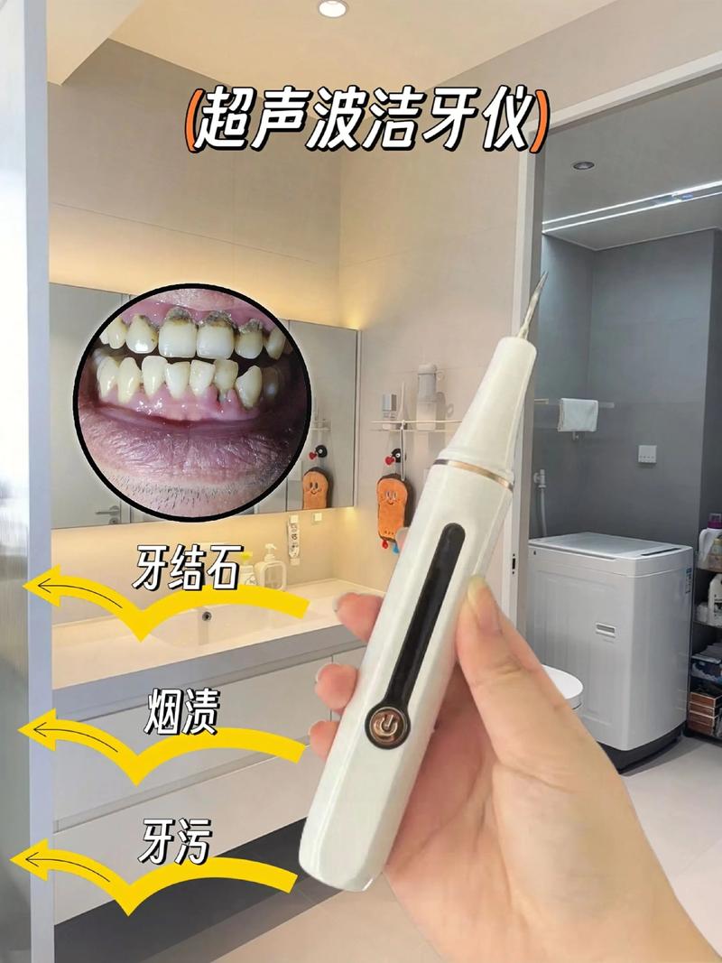 拜博口腔洗牙采用压电技术?原理、效果和安全性如何?-图1 拜博口腔洗牙采用压电技术?原理、效果和安全性如何?-图1
