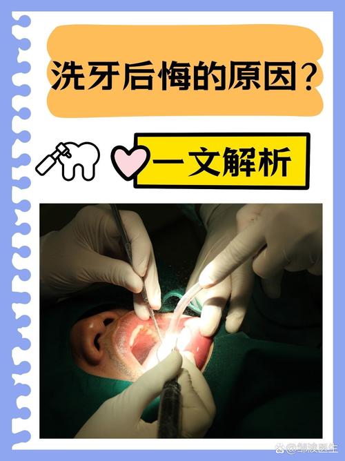 拜博口腔洗牙采用压电技术?原理、效果和安全性如何?-图2 拜博口腔洗牙采用压电技术?原理、效果和安全性如何?-图2