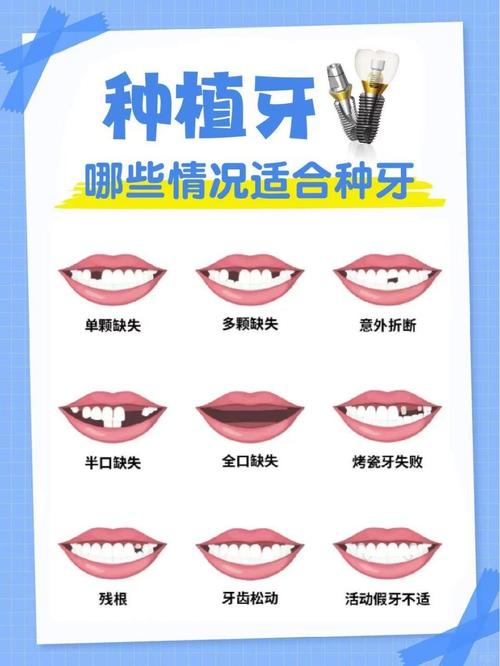 下牙床缺失能种牙吗?-图1 下牙床缺失能种牙吗?-图1