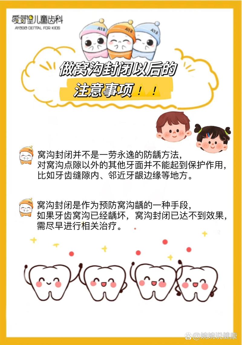 窝沟封闭剂的使用方法-图3 窝沟封闭剂的使用方法-图3