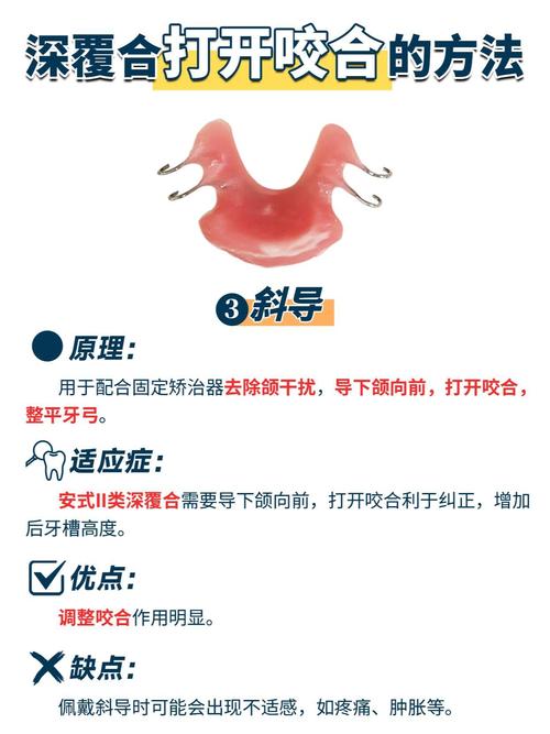 正畸牵引钩如何正确使用?操作步骤与注意事项有哪些?-图1 正畸牵引钩如何正确使用?操作步骤与注意事项有哪些?-图1