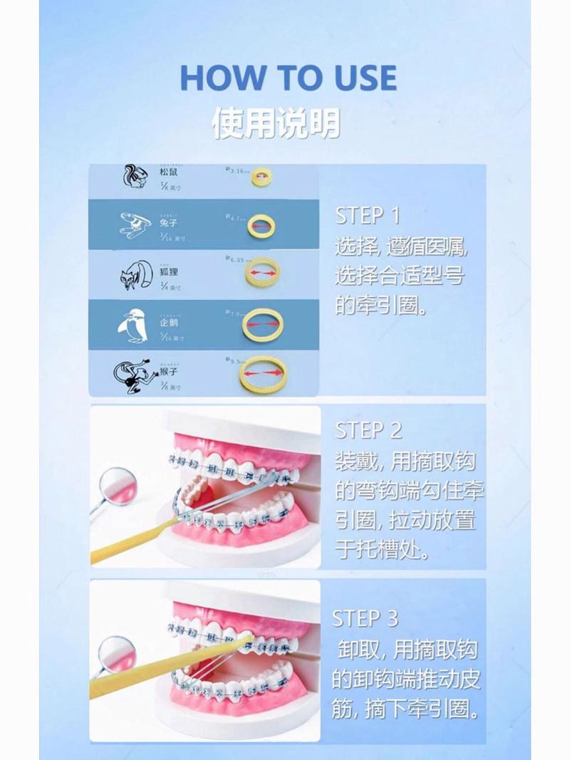 正畸牵引钩如何正确使用?操作步骤与注意事项有哪些?-图3 正畸牵引钩如何正确使用?操作步骤与注意事项有哪些?-图3