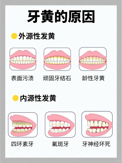 两天让牙齿变白的方法-图2 两天让牙齿变白的方法-图2