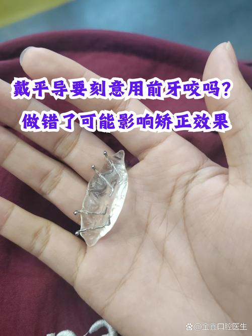 上前牙平导的制作方法详细步骤是怎样的？-图1